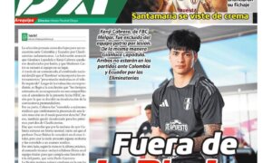 TODO DXT