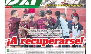 TODO DXT